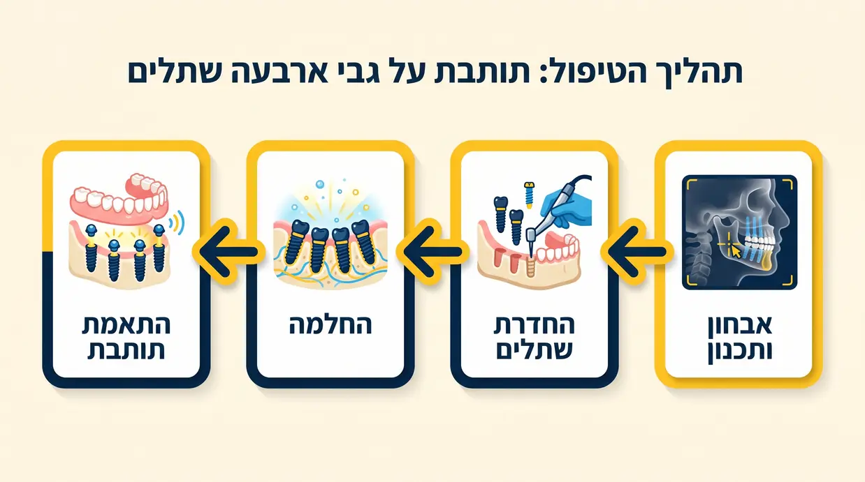 אינפוגרפיקה בעברית המציגה את שלבי תהליך הטיפול בתותבת על ארבעה שתלים