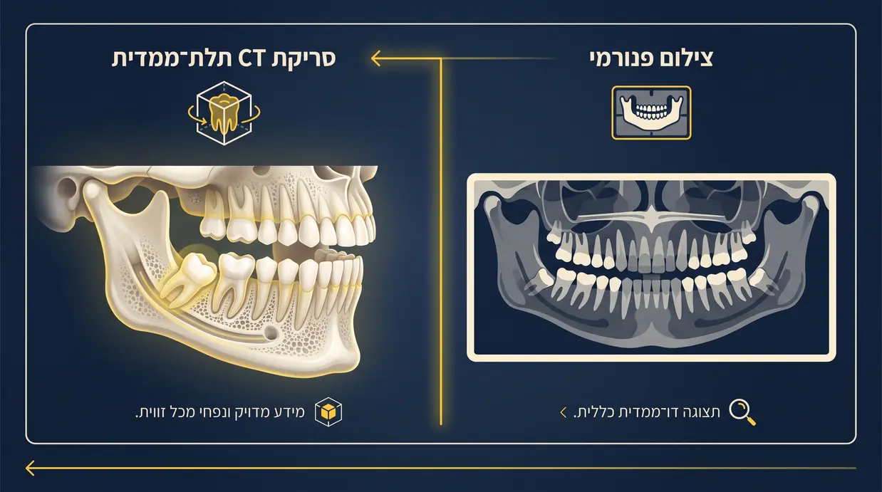 השוואה בין צילום פנורמי לשן בינה לסריקת CT תלת ממדית