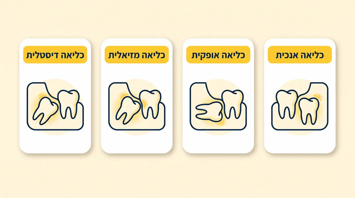 אינפוגרפיקה בעברית המציגה בצורה סכמטית את סוגי הכליאה של שן בינה: אנכית, אופקית, מזיאלית ודיסטלית